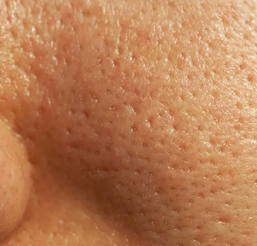 Pore cleansing facial