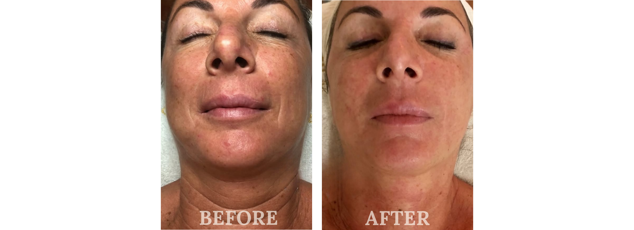 A Natural Difference Skincare EU Certified Before & After