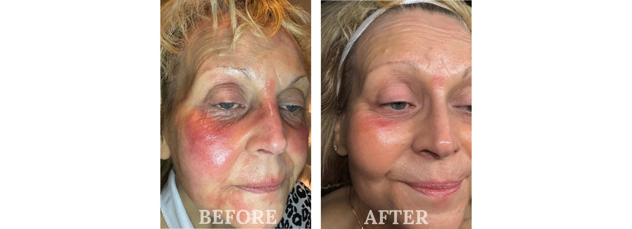 A Natural Difference Skincare EU Certified Before & After