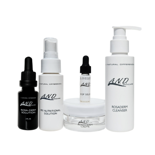 Best skincare routine for rosacea redness and inflammation