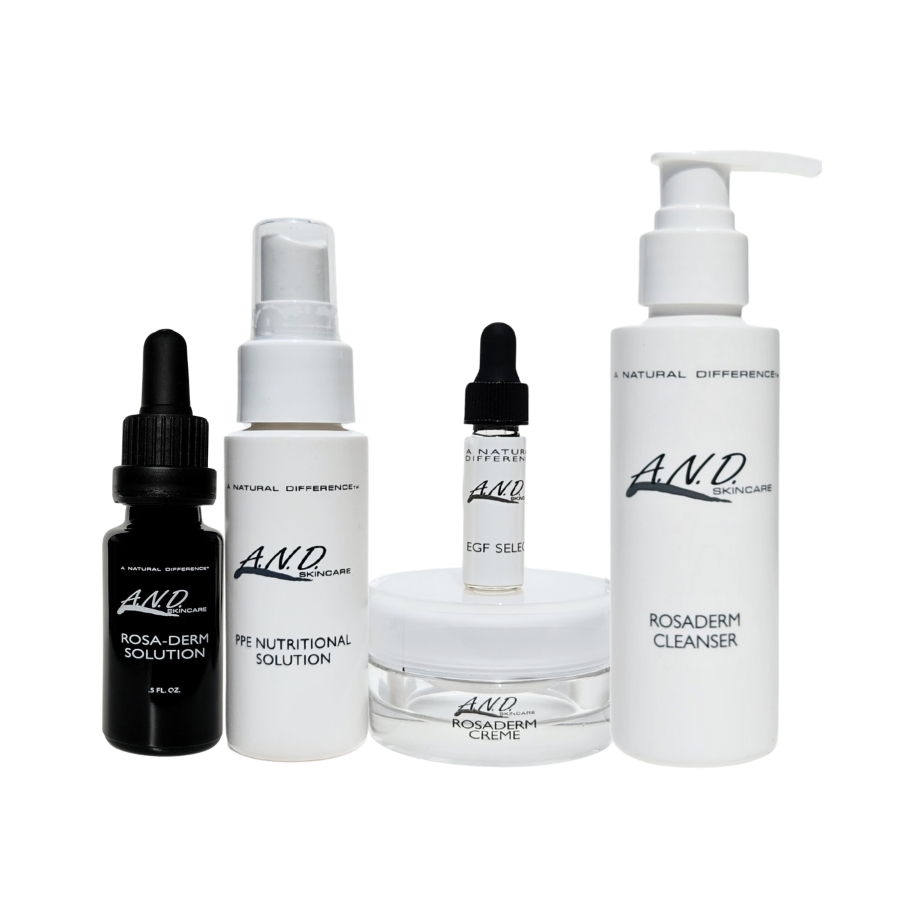 Best skincare routine for rosacea redness and inflammation